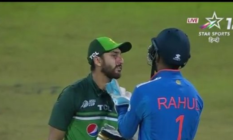 Pakistani Cricketer Agha Salman Suffers Facial Injury in Asia Cup Super 4 Clash Against India
