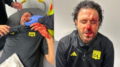 Fabio Grosso: Lyon manager suffers grave injuries after team bus was attacked ahead of Marseille clash